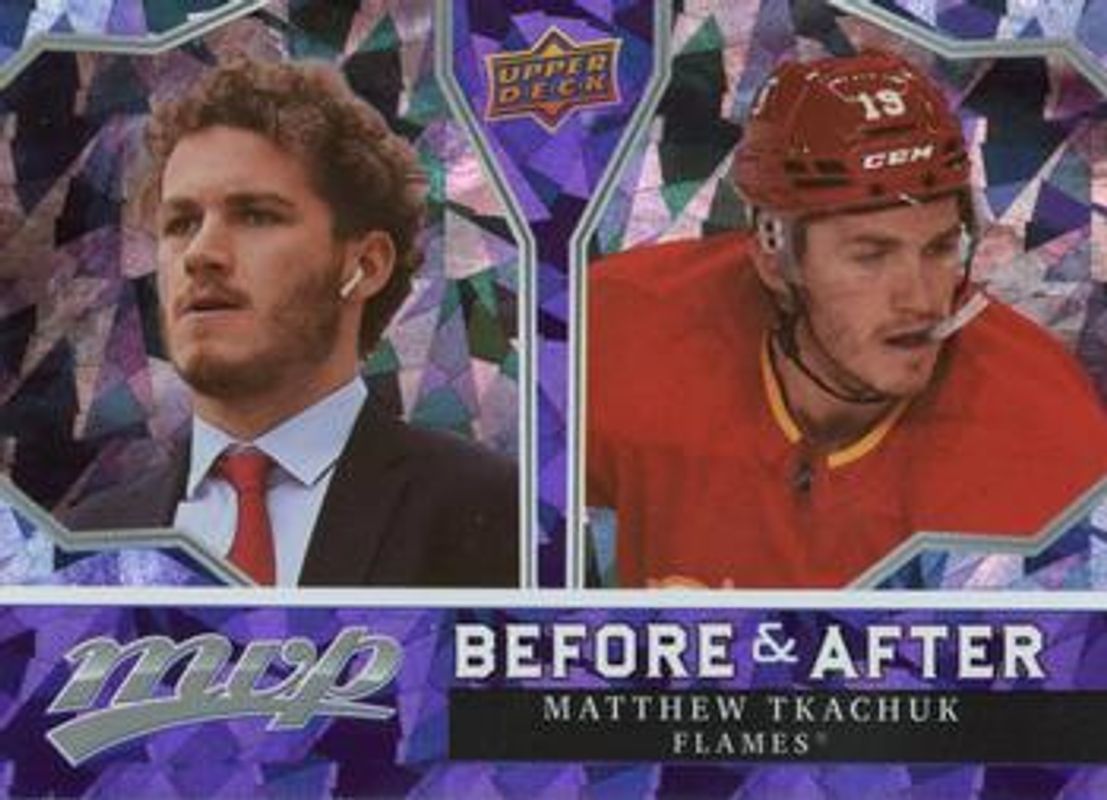 Matthew Tkachuk 2021 Upper Deck MVP #BA-16 Before & After RAW