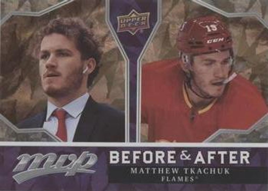 Matthew Tkachuk 2021 Upper Deck MVP #BA-16 Before & After - Gold RAW